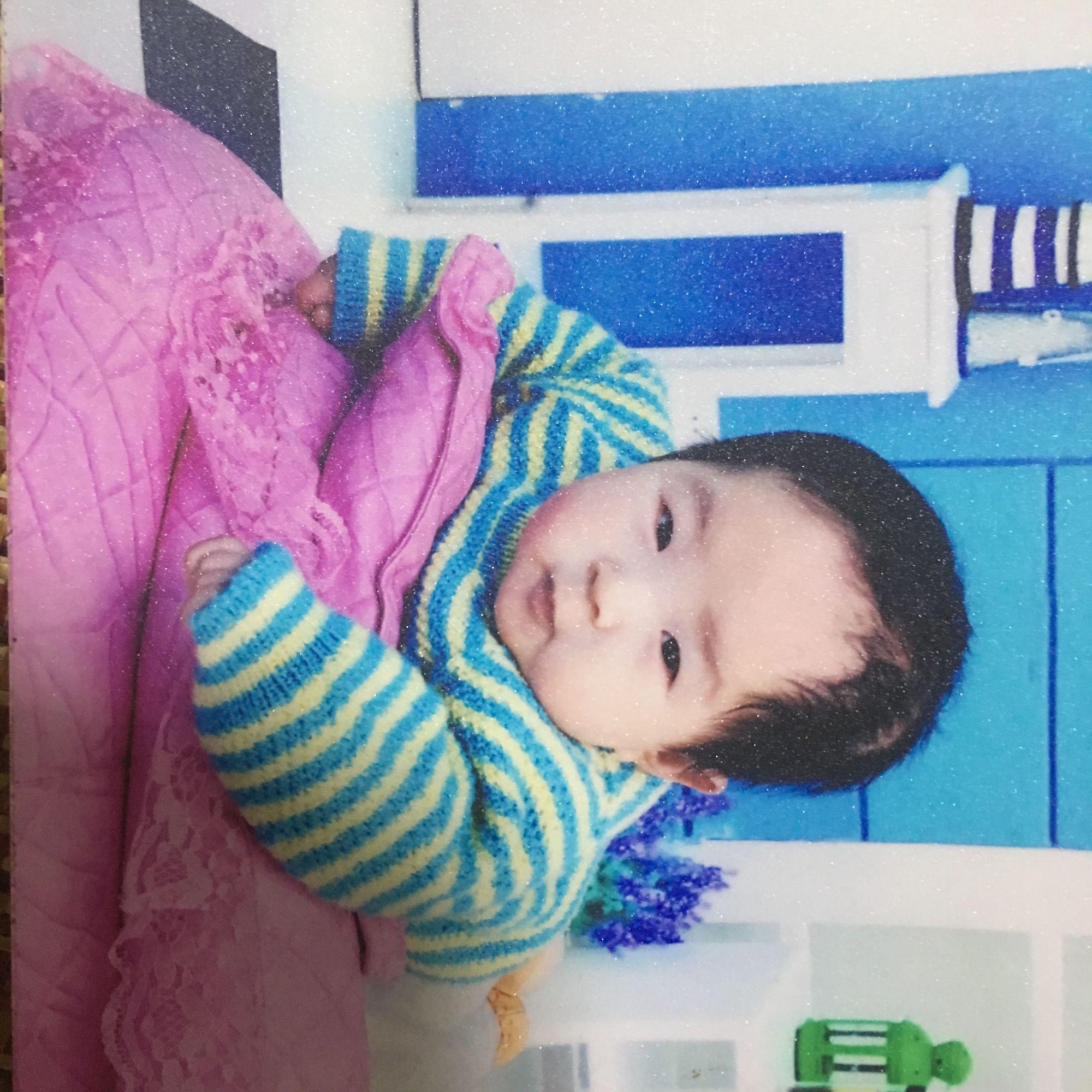 孩子眼白有“黑点”咋回事？多半和这4种原因有关，父母要弄清楚＊ 阿波罗新闻网, image size:2000x2000